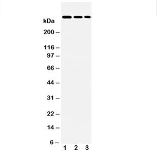 Western blot testing of LAMA2 antibody and Lane 1: HeLa; 2: A549; 3: PANC lysate