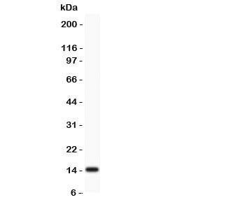 Western blot testing of Profilin 2 antibody and rat brain lysate. Expected/observed size ~15KD