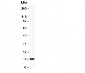 Western blot testing of Profilin 2 antibody and rat brain lysate.  Expected/observed size ~15 kDa.