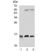 Western blot testing of Profilin 2 antibody and 1) human placenta, 2) rat brain and 3) mouse brain lysate.  Expected/observed size ~15 kDa.