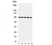 Western blot testing of RGS14 antibody and Lane 1:  rat thymus;  2: (r) spleen;  3: human Raji;  4: (h) CEM;  5: (h) Jurkat cell lysate.  Expected/observed size ~65KD