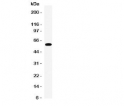 Western blot testing of EAAT3 antibody and human placenta tissue lysate.  Expected molecular weight: 57-70 kDa.