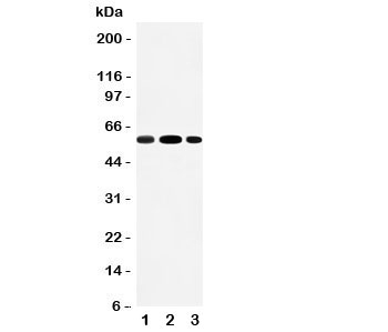 Western blot testing of EAAT3 antibody and Lane 1: rat liver; 2: rat heart; 3: mouse HEPA cell lysate; Expected/observed size ~57KD
