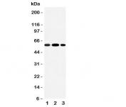 Western blot testing of EAAT3 antibody and Lane 1:  rat liver;  2: rat heart;  3: mouse HEPA cell lysate;  Expected molecular weight: 57-70 kDa.