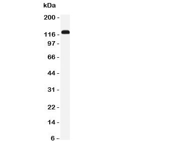 Western blot testing of NKCC2 antibody and rat kidney tissue lysate. Expected/observed size ~121KD