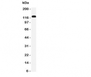 Western blot testing of NKCC2 antibody and rat kidney tissue lysate.  Expected/observed molecular weight ~121kDa.