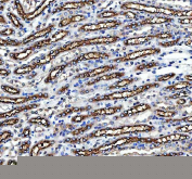 IHC staining of FFPE mouse kidney tissue with NKCC2 antibody, HRP-secondary and DAB substrate. HIER: boil tissue sections in pH8 EDTA for 20 min and allow to cool before testing.