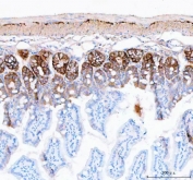 IHC staining of FFPE mouse colon tissue with NKCC1 antibody. HIER: boil tissue sections in pH8 EDTA for 20 min and allow to cool before testing.