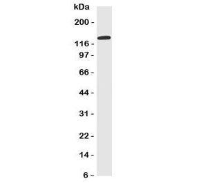 Western blot testing of NKCC1 antibody and HeLa cell lysate. Expected/observed size ~130KD