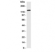 Western blot testing of NKCC1 antibody and human HeLa cell lysate.  Expected molecular weight: 130-180 kDa depending on glycosylation level.
