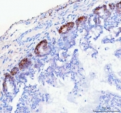 IHC staining of FFPE rat colon tissue with NKCC1 antibody. HIER: boil tissue sections in pH8 EDTA for 20 min and allow to cool before testing.