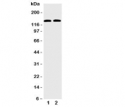 Western blot testing of SLC12A6 antibody and Lane 1:  HeLa;  2: HUT102 cell lysate.  Expected/observed size ~128KD