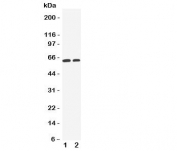 Western blot testing of OCT1 antibody and Lane 1:  human HeLa cell lysate;  2: human A549 cell lysate.  Predicted molecular weight ~61 kDa but this glycoprotein may be observed at up to ~80 kDa.