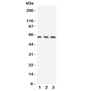 Western blot testing of SLC22A3 antibody and Lane 1: rat liver; 2: human 293T; 3: (h) A549 cell lysate. Expected/observed size ~61KD