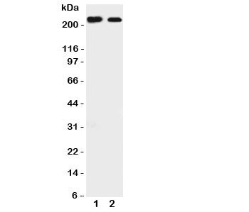 Western blot testing of Tuberin antibody and Lane 1: rat liver; 2: mouse HEPA cell lysate. Expected/observed size 200~220KD