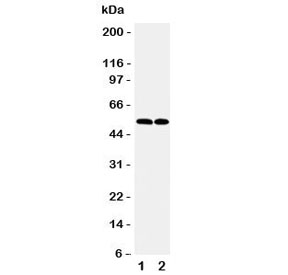 Western blot testing of CCR3 antibody and Lane 1: K562; 2: Raji cell lysate. Visualized from 40~55 kDa~
