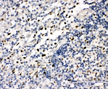 IHC-P: FLI1 antibody testing of human tonsil tissue. HIER: steamed with pH6 citrate buffer.