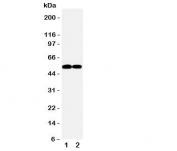 Western blot testing of FLI1 antibody and Lane 1:  Jurkat;  2: Raji cell lysate. Predicted/observed molecular weight: ~51kDa.