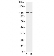 Western blot testing of human 1) HeLa and 2) COLO320 cell lysate with HDAC5 antibody.  Predicted molecular weight ~122 kDa, observed at 122-160 kDa.