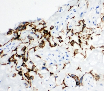 IHC-F testing of HYAL1 antibody and human placenta tissue