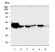 Western blot testing of 1) human HepG2, 2) human PC-3, 3) monkey COS-7, 4) rat liver, 5) mouse liver and 6) mouse kidney tissue lysate with HYAL1 antibody. Expected molecular weight: 48-60 kDa.