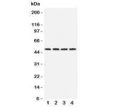 Western blot testing of HYAL1 antibody and Lane 1:  rat NRK;  2: mouse liver;  3: (m) kidney;  4: (m) SP2/0 cell lysate