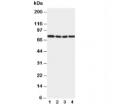 Western blot testing of IRAK1 antibody and Lane 1:  rat liver;  2: human placenta;  3: MCF-7;  4: PANC cell lysate. Predicted/observed molecular weight: ~76 kDa.