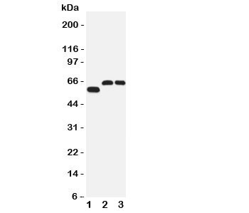 Western blot testing of SLC1A4 antibody and Lane 1: human U87; 2: rat brain; 3: mouse brain tissue lysate. Expected/observed size 60~80KD~