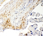 IHC-P: MCT5 antibody testing of human placenta cancer tissue