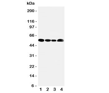 Western blot testing of MCT5 antibody and Lane 1: rat testis; 2: human Jurkat; 3: (h) HeLa; 4: (h) MCF-7 cell lysate. Expected/observed size ~54KD