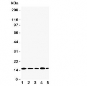 Western blot testing of TIA-1 antibody and Lane 1:  Jurkat;  2: Raji;  3: CEM;  4: HT1080;  5: K562 cell lysate.  Predicted molecular weight: ~43kDa and ~15kDa (granulocyte-associated isoform).