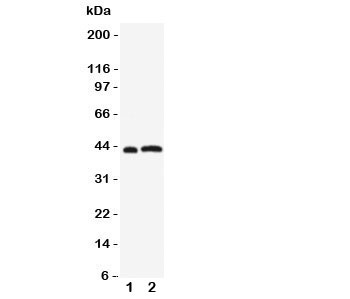Western blot testing of Leupaxin antibody and Lane 1: rat thymus; 2: human Jurkat cell lysate. Expected/observed size ~43KD