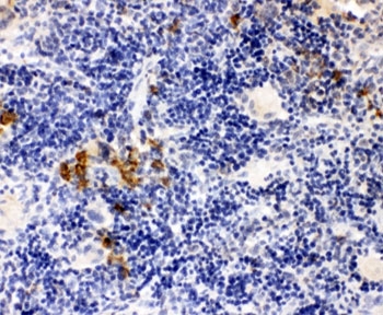 IHC-P: Leupaxin antibody testing of rat spleen tissue