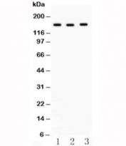Western blot testing of ACE antibody and (1) HeLa, (2) A549 and (3) 22RV1 lysate. Expected molecular weight 140-170 kDa.