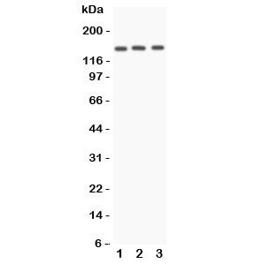 Western blot testing of Angiotensin Converting Enzyme antibody and Lane 1: A549; 2: HeLa; 3: 22RV1 lysate. Expected/observed size ~150KD