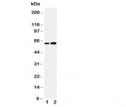 Western blot testing of CDC6 antibody and Lane 1:  Jurkat;  2: MCF-7 cell lysate.  Predicted/observed molecular weight: ~62kDa