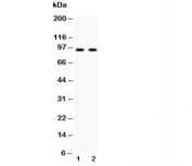 Western blot testing of Cadherin 17 antibody and Lane 1:  HeLa;  2: SW620 lysate