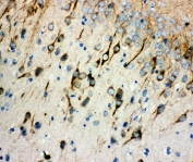 IHC staining of FFPE rat brain with AChR antibody at 1ug/ml. HIER: boil tissue sections in pH6, 10mM citrate buffer, for 10-20 min and allow to cool before testing.