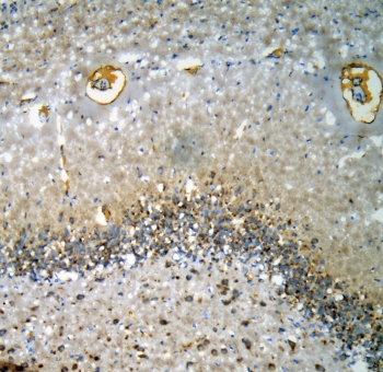 IHC staining of FFPE rat brain with AChR antibody at 1ug/ml. HIER: boil tissue sections in pH6, 10mM citrate buffer, for 10-20 min and allow to cool before testing.