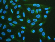 IF/ICC staining of FFPE human U-2 OS cells with AChR antibody (green) at 2ug/ml and DAPI nuclear stain (blue). HIER: steam section in pH6 citrate buffer for 20 min.
