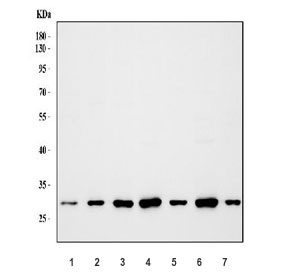 Western blot testing of 1) human placenta, 2) human K562, 3) human SH-SY5Y, 4) rat brain, 5) rat liver, 6) mouse brain and 7) mouse liver lysate with COMT antibody. Predicted molecular weight: ~30/25 kDa (isoforms 1/2).
