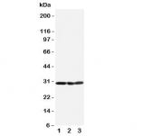 Western blot testing of human 1) HeLa, 2) A375 and 3) PANC cell lysate with COMT antibody. Predicted molecular weight: ~30/25kDa (isoforms 1/2).