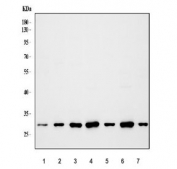 Western blot testing of 1) human placenta, 2) human K562, 3) human SH-SY5Y, 4) rat brain, 5) rat liver, 6) mouse brain and 7) mouse liver lysate with COMT antibody. Predicted molecular weight: ~30/25 kDa (isoforms 1/2).