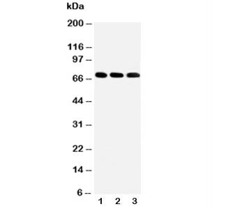 Western blot testing of IRAKM antibody and Lane 1: HeLa; 2: Jurkat; 3: HUT102 cell lysate