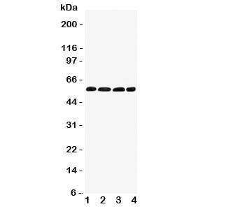 Western blot testing of IRF5 antibody and Lane 1: human placenta; 2: rat thymus; 3: (r) kidney; 4: (r) ovary tissue lysate. Expected/observed size ~55KD
