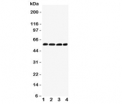 Western blot testing of IRF5 antibody and Lane 1:  human placenta;  2: rat thymus;  3: (r) kidney;  4: (r) ovary tissue lysate.  Expected/observed molecular weight ~57kDa.