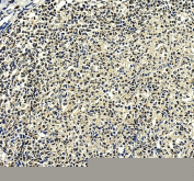 IHC staining of FFPE human tonsil tissue with IRF8 antibody, HRP-secondary and DAB substrate. HIER: boil tissue sections in pH8 EDTA for 20 min and allow to cool before testing.