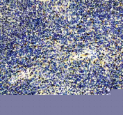 IHC staining of FFPE mouse spleen tissue with IRF8 antibody, HRP-secondary and DAB substrate. HIER: boil tissue sections in pH8 EDTA for 20 min and allow to cool before testing.