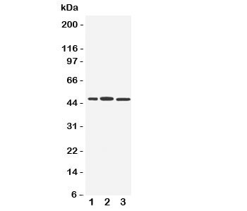 Western blot testing of IRF8 antibody and Lane 1: human Raji; 2: rat liver; 3: (r) kidney tissue lysate. Expected/observed size ~48KD