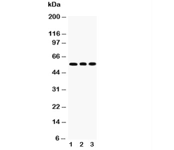 Western blot testing of KLF4 antibody and Lane 1: HeLa; 2: A549; 3: U20S cell lysate. Predicted molecular weight: 50-60 kDa + ~75 kDa